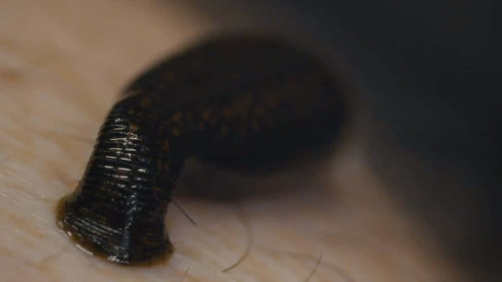  壁紙 — 深色水蛭附著在人體皮膚上的特寫，可見脊狀紋理和毛髮。