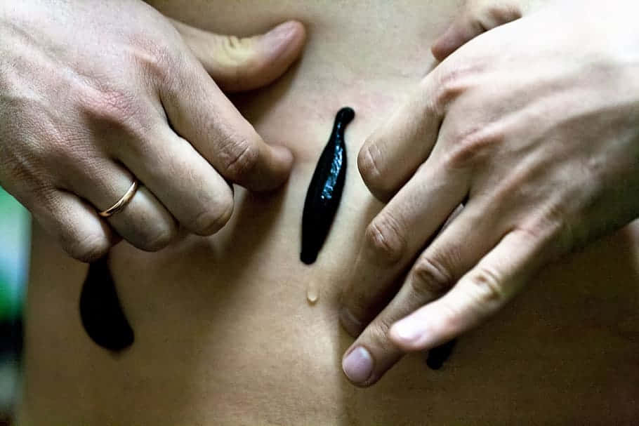  壁紙 — 傳統療法中使用黑色水蛭於裸露皮膚上的手部特寫。