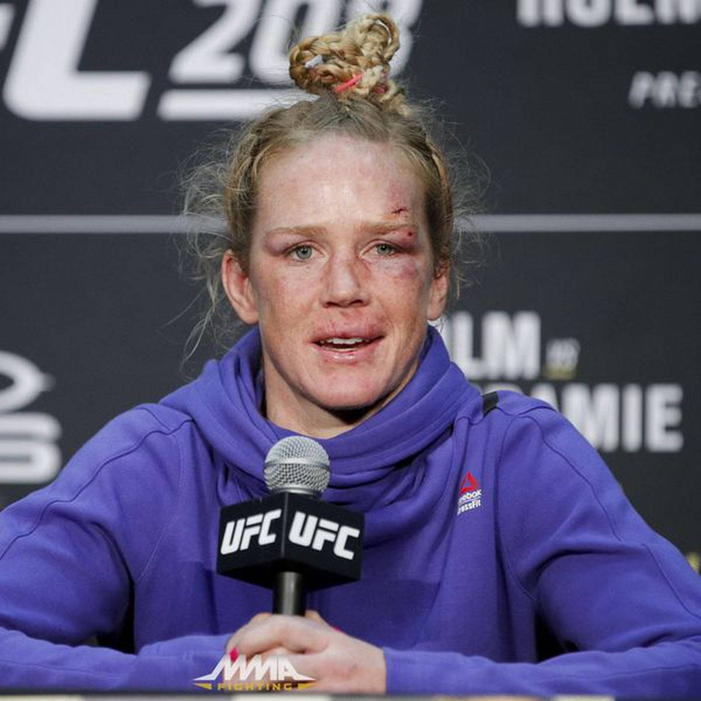 MMA 桌布 壁紙 — 一位女性UFC拳手，臉上帶有明顯瘀傷和傷口，在記者會上情緒激動地對著麥克風發言。