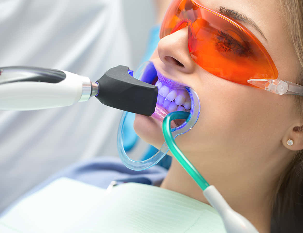 Teeth Whitening 桌布 壁紙 — 一位戴著橙色護目鏡的女性正在接受牙齒美白治療，使用牙科雷射和藍色托盤。