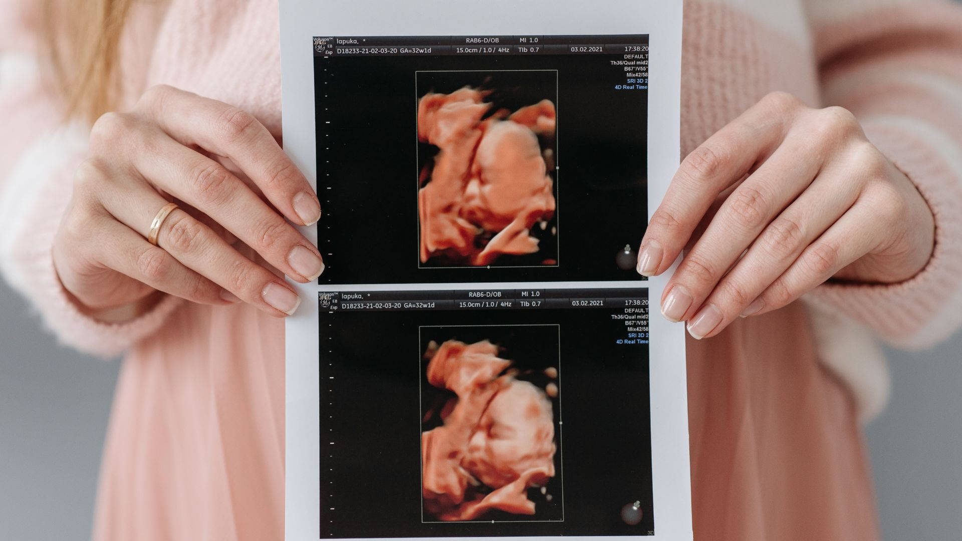 Pregnant 桌布 壁紙 — 一位穿著粉紅色毛衣的人手持兩張超音波圖像，顯示發育中胎兒的詳細3D視圖。