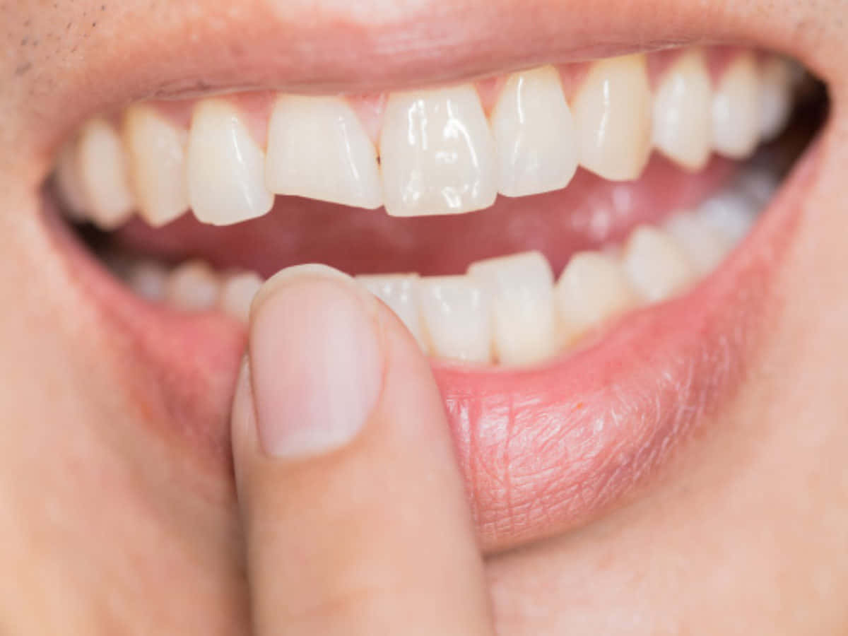 Teeth Whitening 桌布 壁紙 — 一個人嘴巴的特寫，手指輕輕觸碰牙齒附近的下唇。
