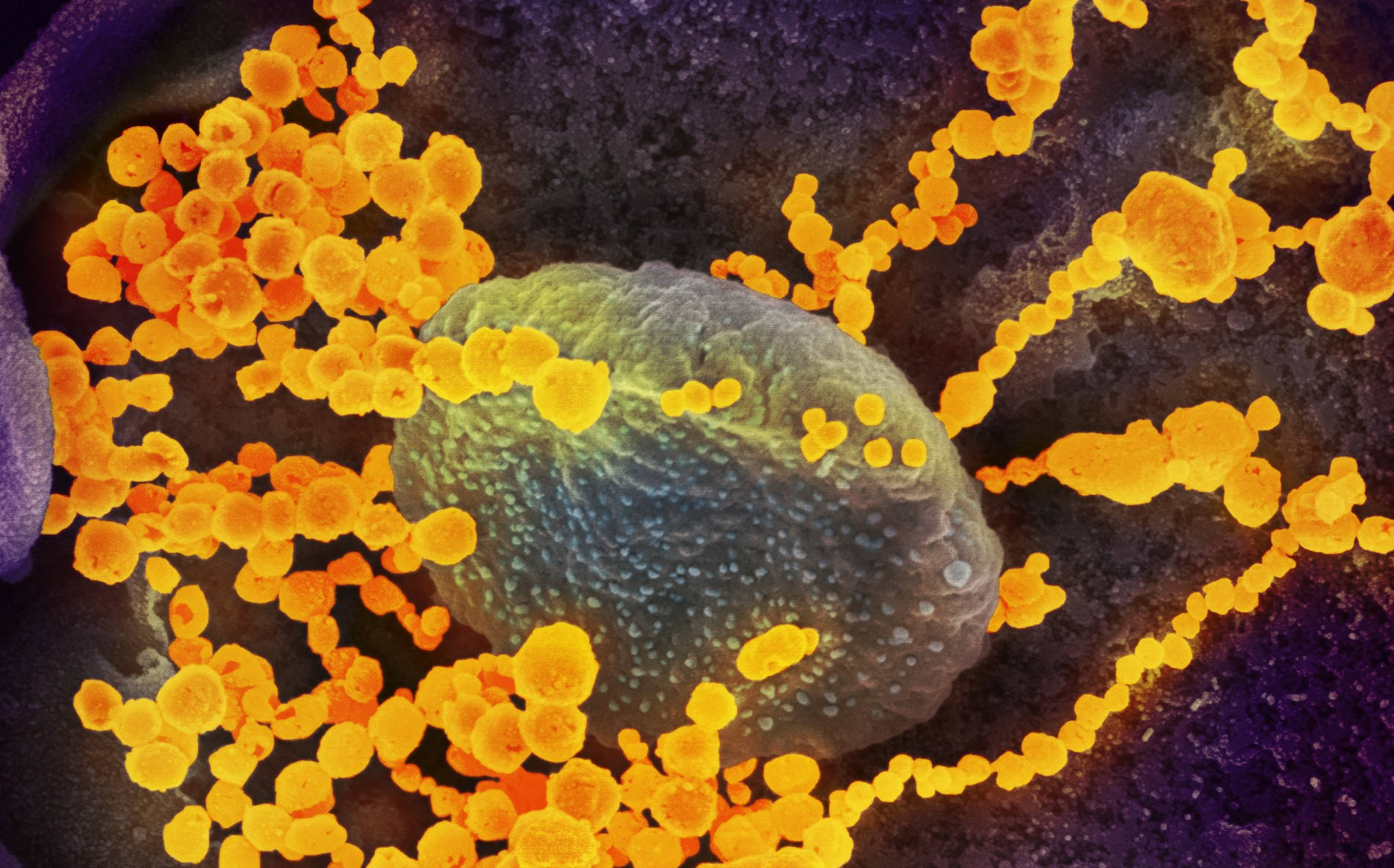 Coronavirus 桌布 壁紙 — 一個充滿活力的顯微鏡視圖顯示發光的橙色病毒顆粒聚集在一個有紋理的綠藍色細胞周圍，背景為深紫色。