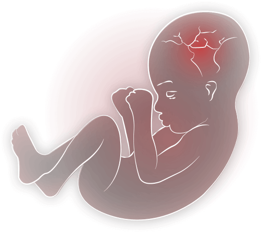 Womb 桌布 壁紙 — 一個風格化的插圖，描繪蜷縮的胎兒形象，以紅色調呈現於深色背景上。