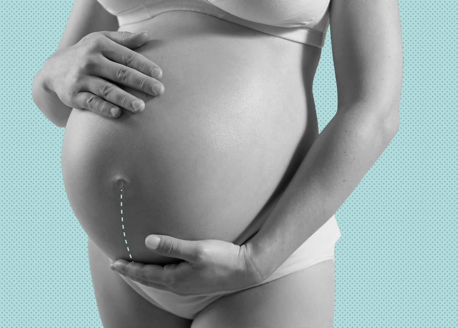 Pregnant 桌布 壁紙 — 一名孕婦在青綠色圓點背景前抱著腹部，可見手術疤痕。