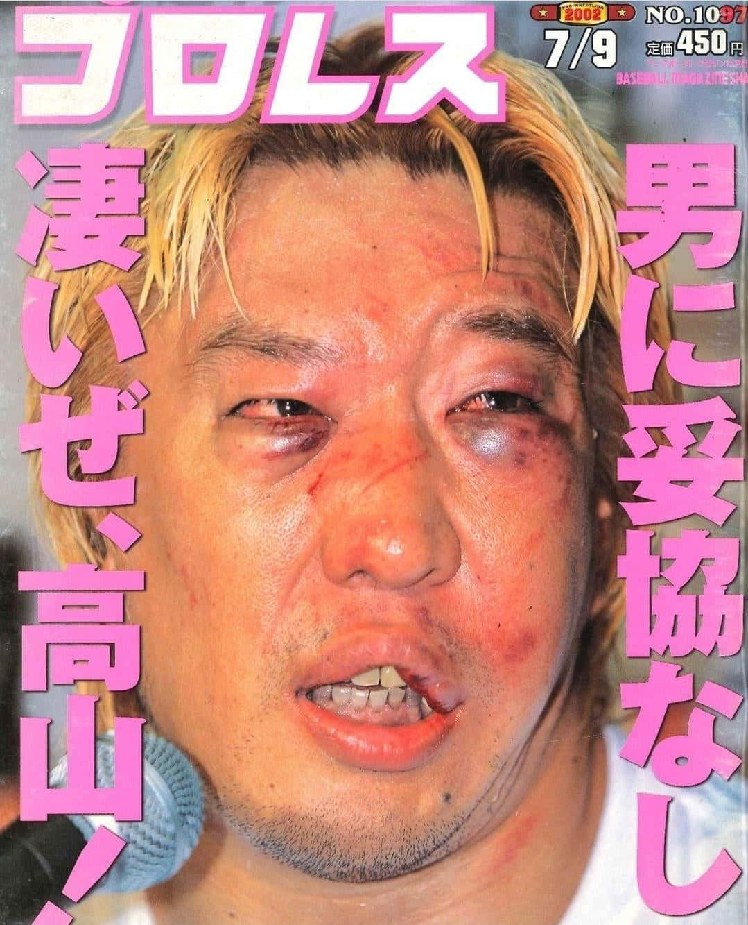 Magazine 桌布 壁紙 — 一張日本棒球運動員瘀傷流血、表情強烈、手持麥克風的特寫照片。
