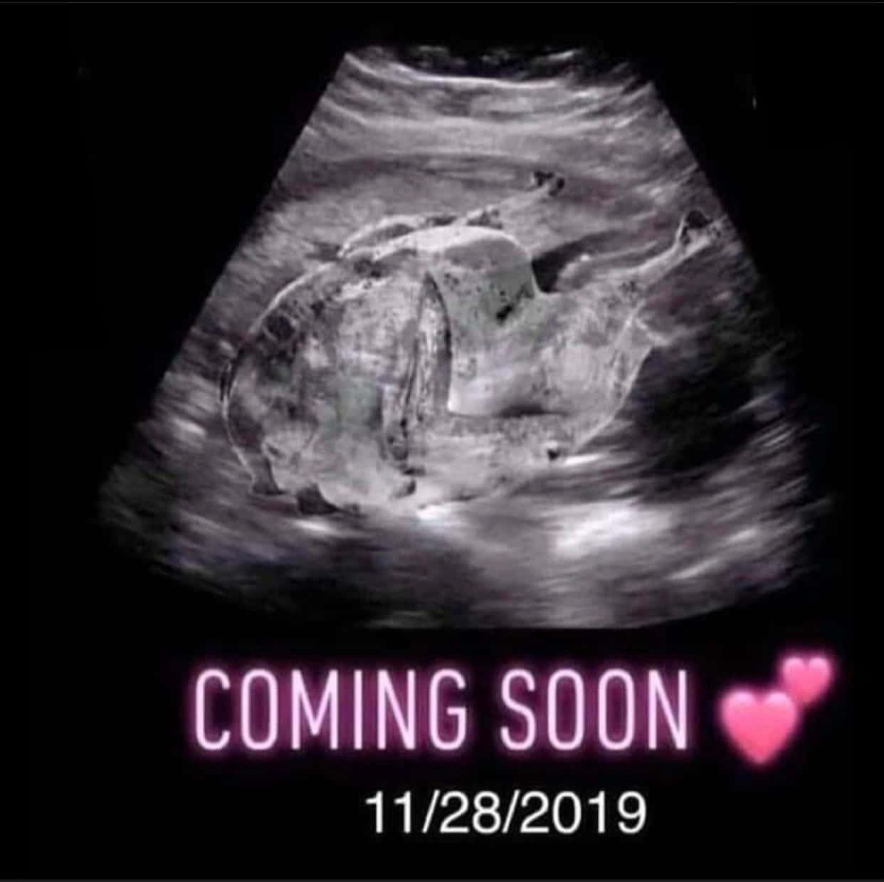 pregnancy 桌布 壁紙 — 一張灰階超音波圖像顯示一個蜷縮的胎兒，並有文字宣佈嬰兒於2019年11月28日到來。