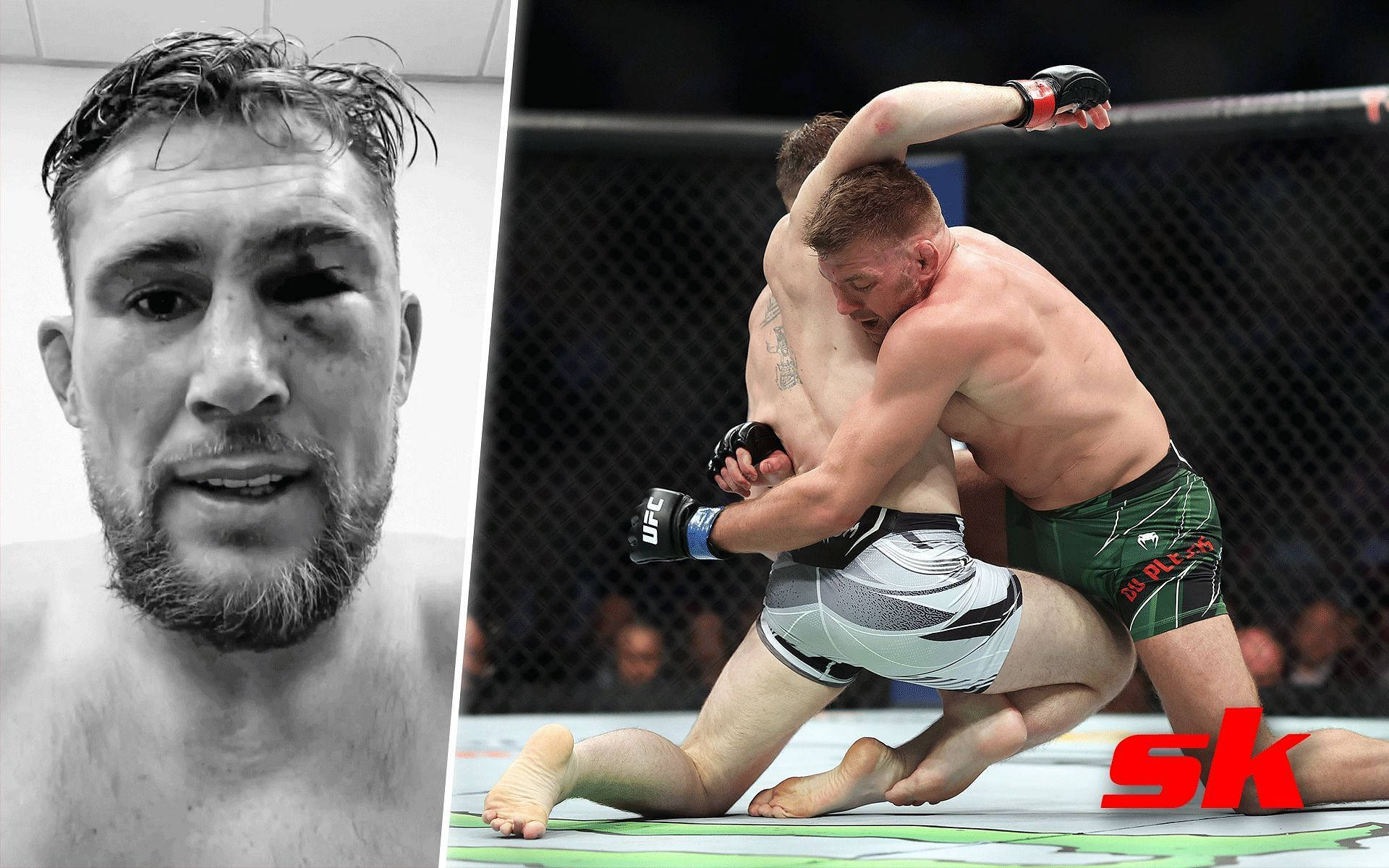 UFC 桌布 壁紙 — 一張黑白肖像，描繪一名眼部瘀傷的拳手，旁邊是一張彩色動作照片，顯示兩名拳手在UFC八角籠內纏鬥。