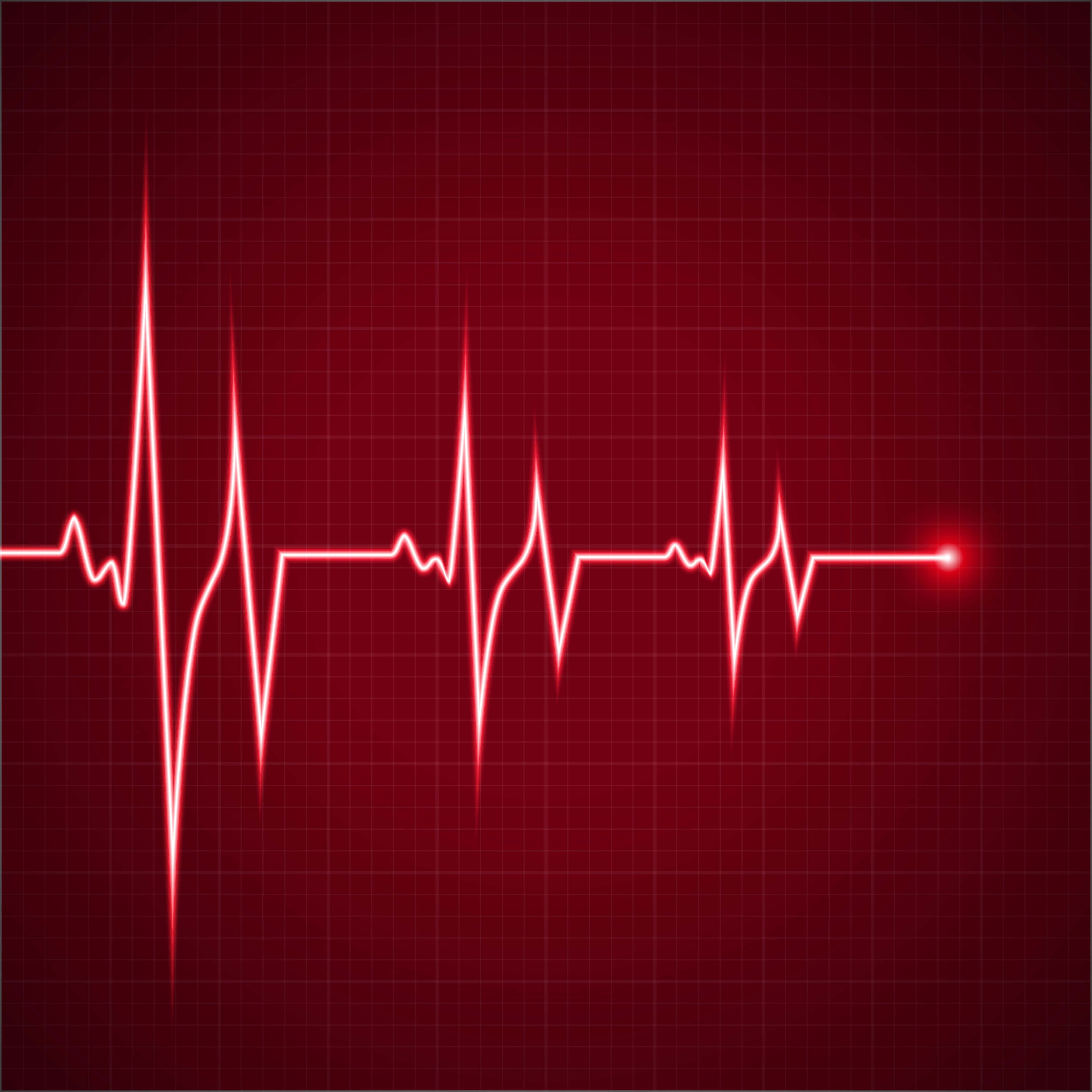 Heart Rate 桌布 壁紙 — 一條發光的紅色心電圖線在深紅色網格背景上脈動，末端漸變為一個亮點。