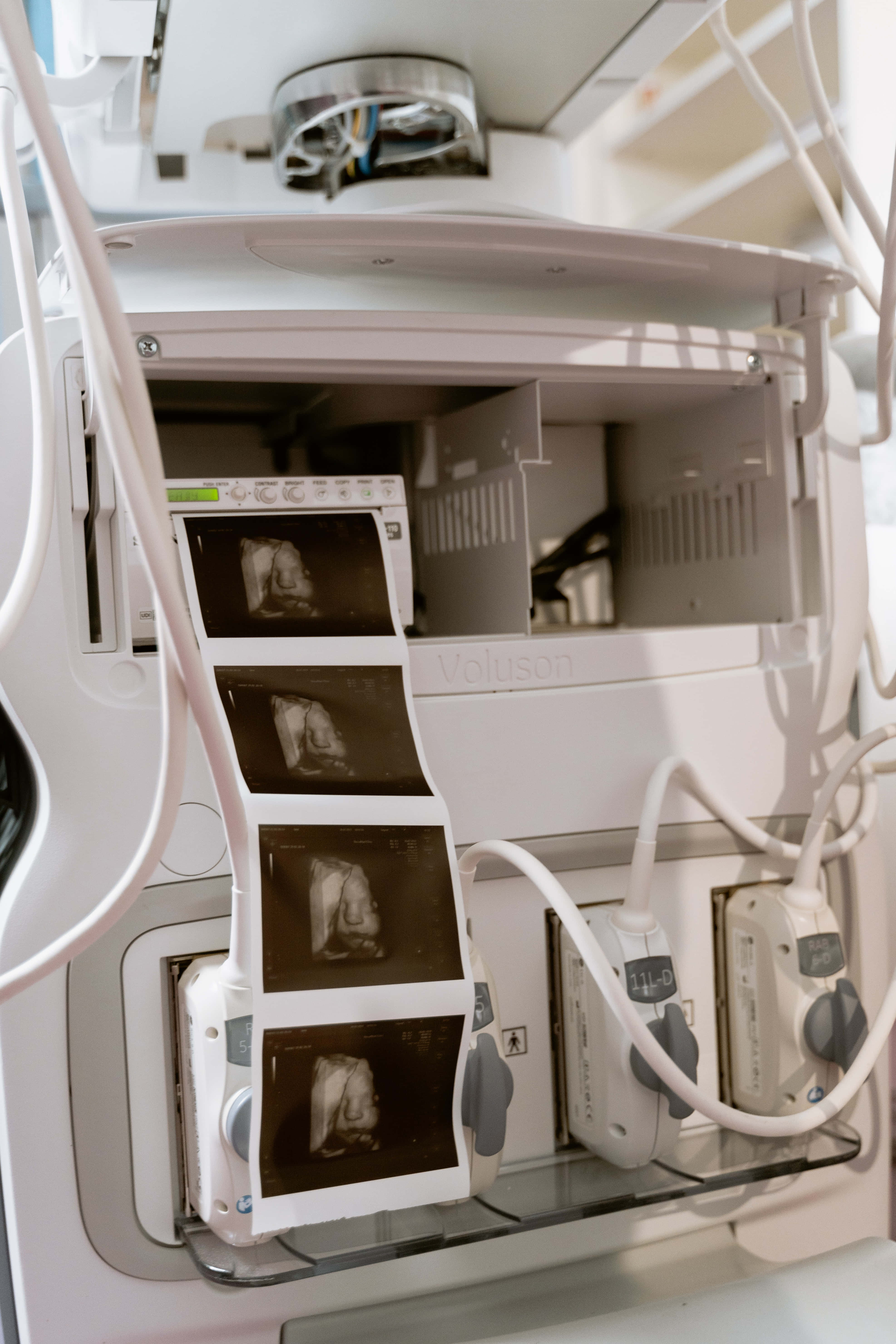 Ultrasound 桌布 壁紙 — 一部醫療超音波機器的特寫，其印表機中彈出一條帶有四張灰階胎兒超音波圖像的紙條。