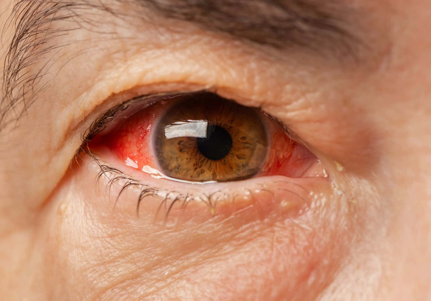 Eye 桌布 壁紙 — 人類眼睛的極端特寫，帶有發紅和可見的刺激，顯示詳細的皮膚紋理和睫毛。