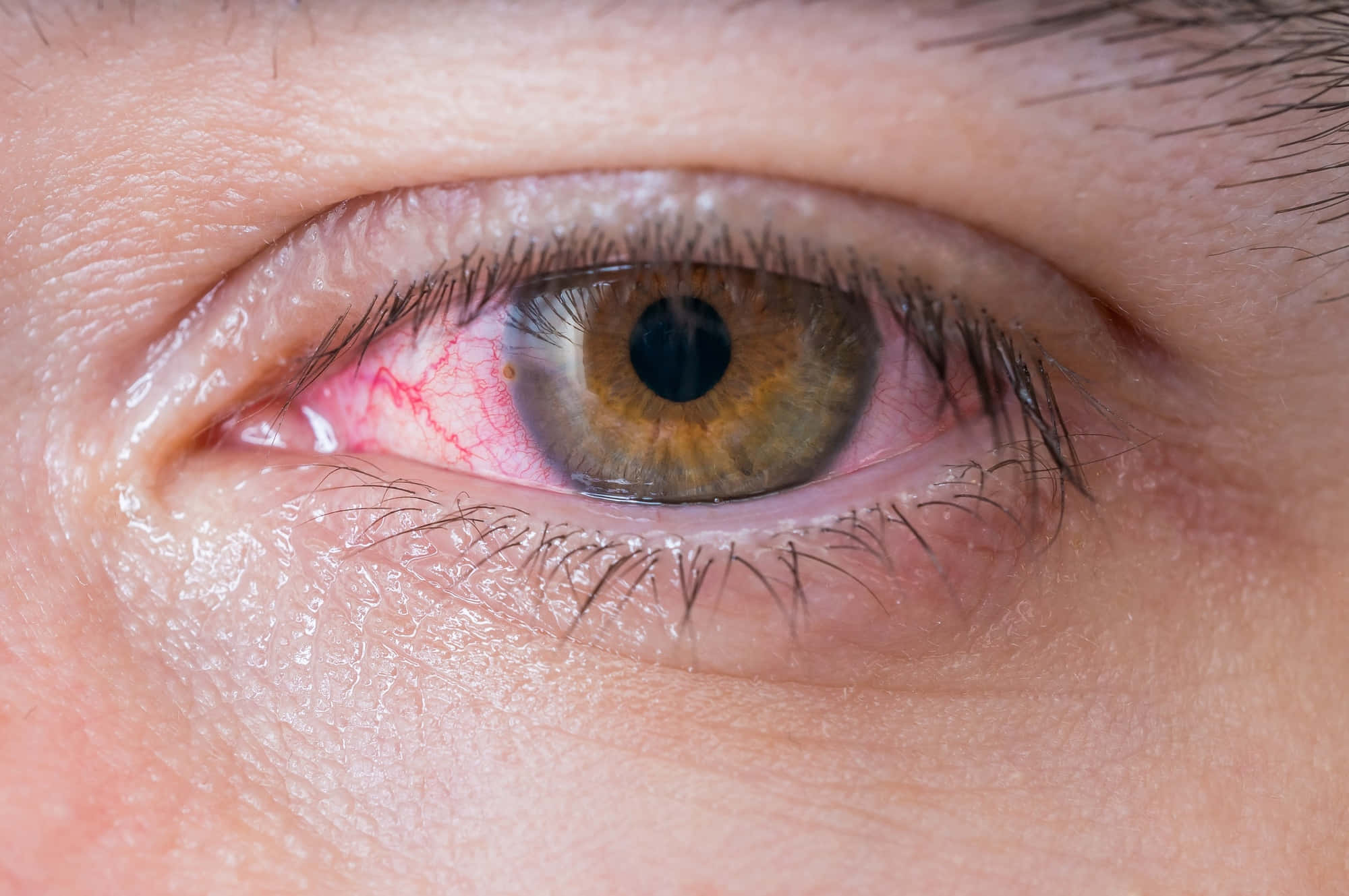 Eye 桌布 壁紙 — 人類眼睛的極端特寫，帶有紅色充血鞏膜和詳細的睫毛。