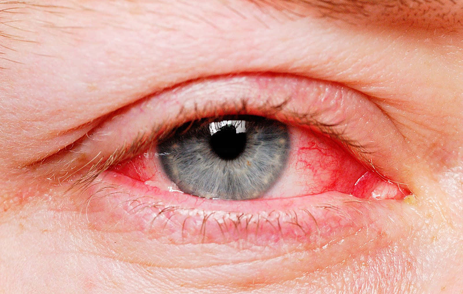 Eye 桌布 壁紙 — 人類眼睛的極端特寫，顯示紅色受刺激的鞏膜和灰色虹膜，展現詳細的皮膚紋理。
