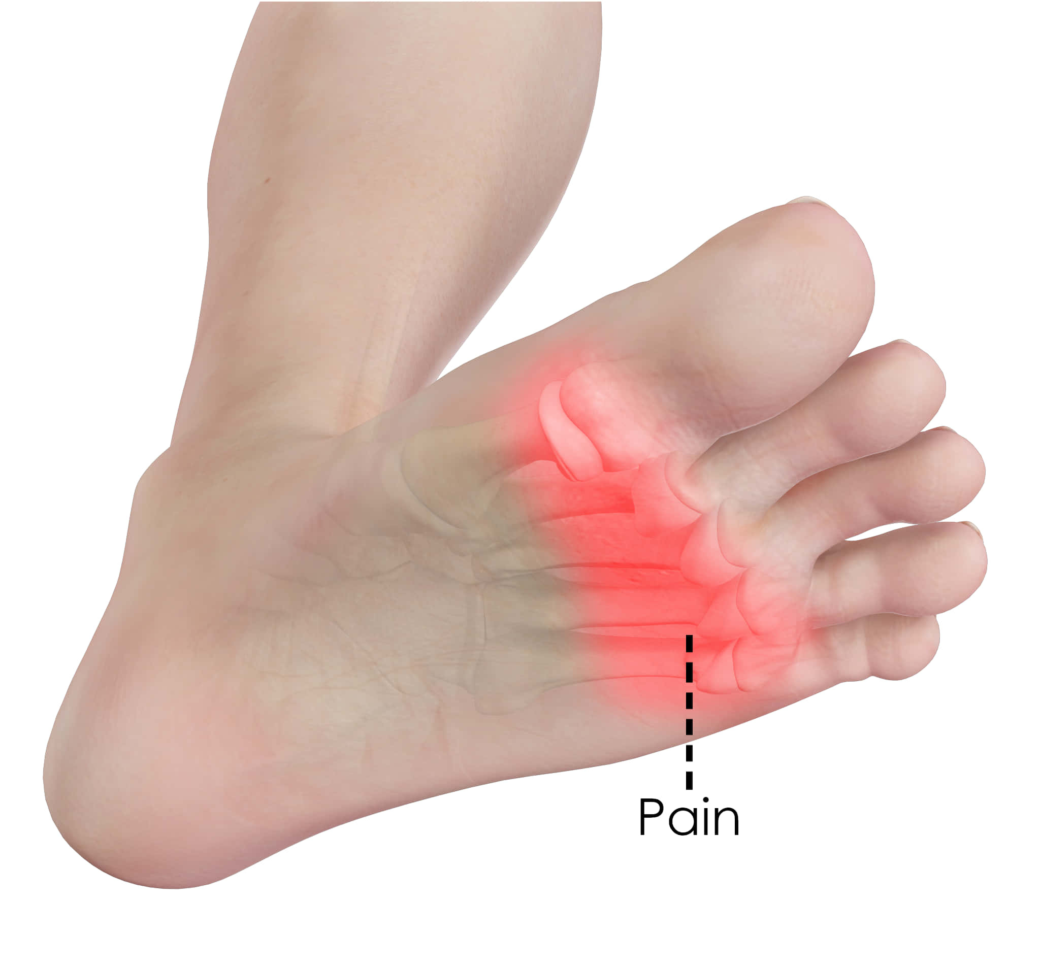 feet 桌布 壁紙 — 人類腳部透明解剖圖，突出顯示腳掌球附近標示為疼痛的紅色疼痛區域。