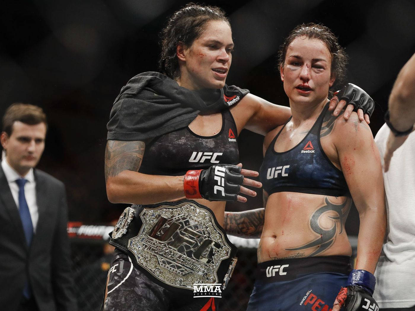 Champion 桌布 壁紙 — 兩名穿著UFC裝備、筋疲力竭的女性MMA拳手在賽後擁抱，其中一人手持冠軍腰帶，兩人均顯示瘀傷和血跡。