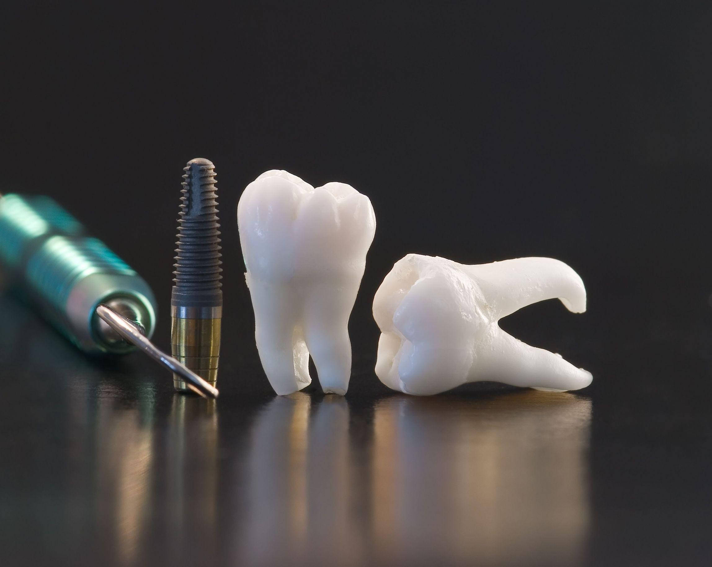 Dentistry 桌布 壁紙 — 牙科工具和模型的特寫，包括一個牙齒植入物和一個拔出的牙齒，放置在反光的黑色表面上。