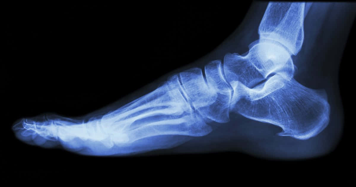 feet 桌布 壁紙 — 發光的藍色X光片在純黑背景上揭示了人類腳部複雜的骨骼結構。
