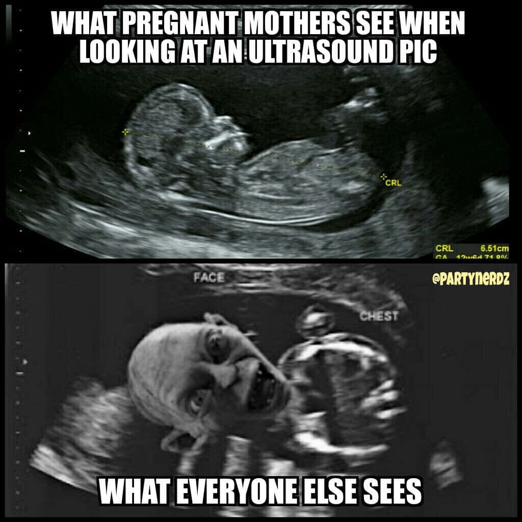 pregnancy 桌布 壁紙 — 胎兒的超音波圖像被幽默地編輯成一個帶有文字疊加的可怕面孔。