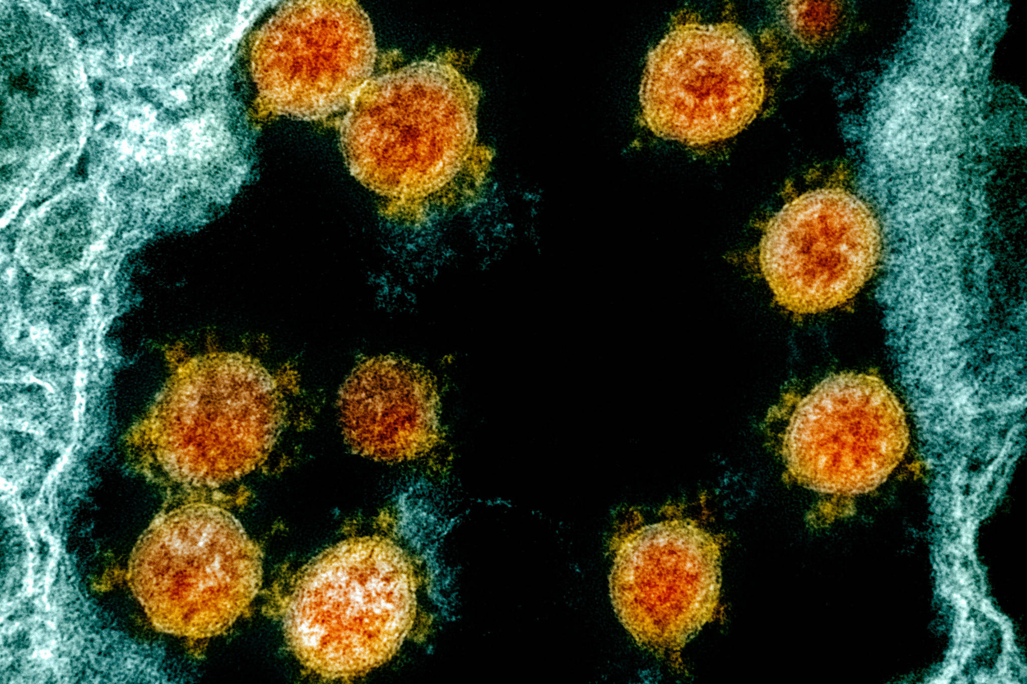 Coronavirus 桌布 壁紙 — 色彩鮮豔的病毒粒子在黑暗背景上漂浮，帶有發光的青綠色細胞結構。