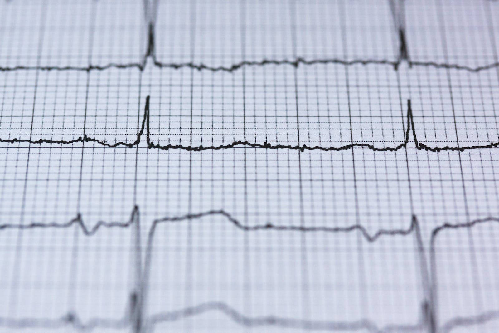 Heartbeat 桌布 壁紙 — 醫療心電圖圖表的特寫，在淺景深的網格紙上顯示心跳波。