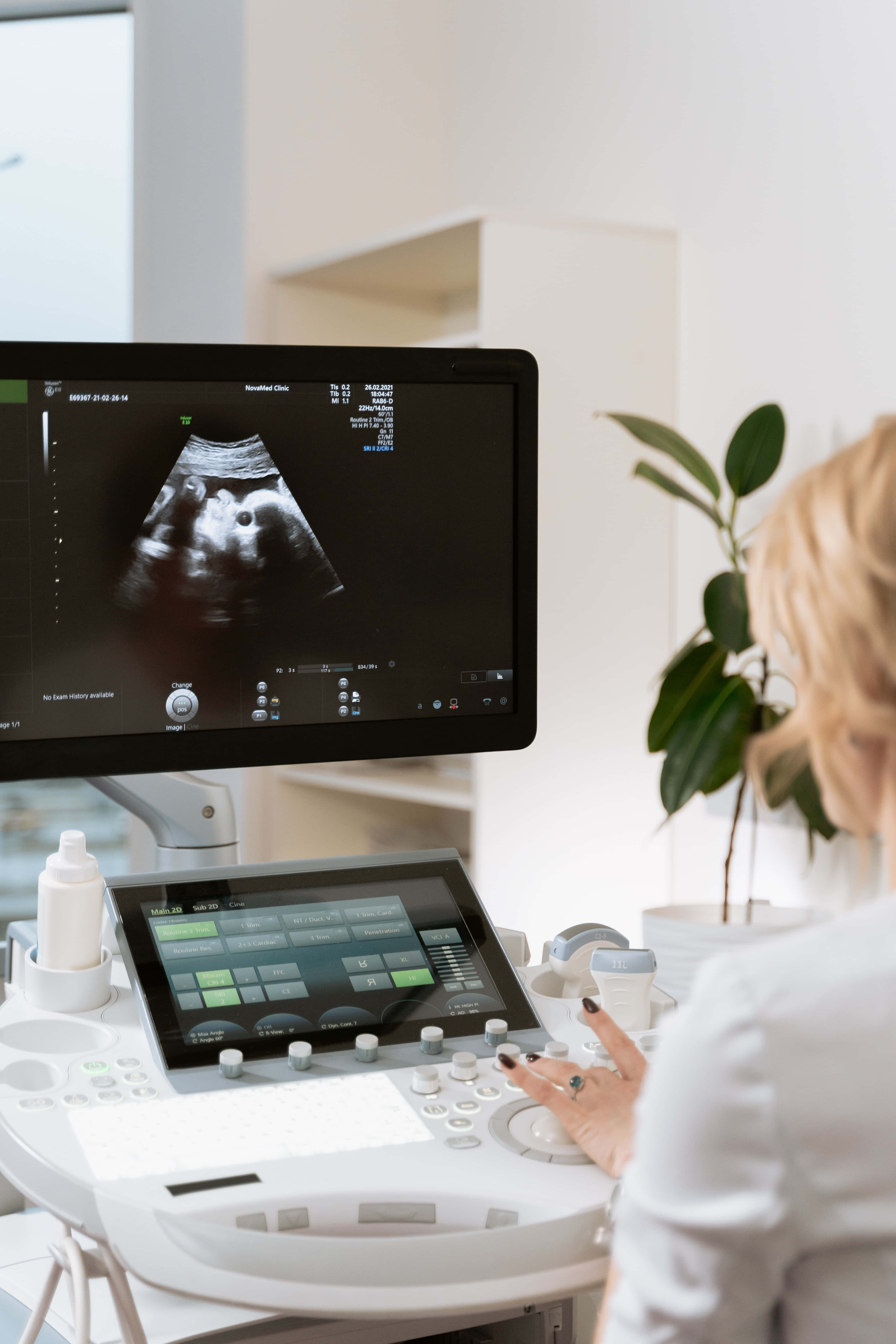 Ultrasound 桌布 壁紙 — 醫護專業人員操作超音波機器，螢幕上顯示灰階胎兒影像，處於明亮的臨床環境中。