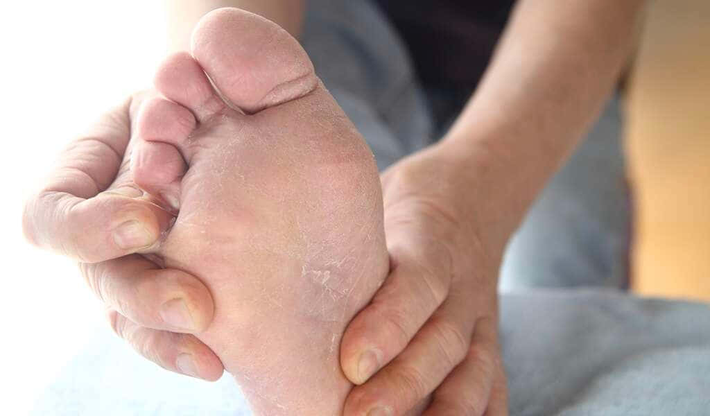 feet 桌布 壁紙 — 雙手輕柔地捧著一隻皮膚乾燥脫皮的腳的特寫，展現質感和護理。