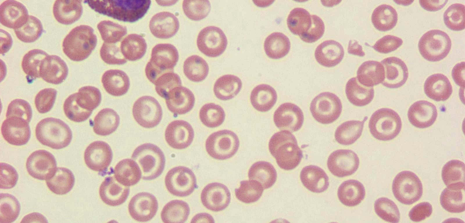 Red Blood Cells 桌布 壁紙 — 顯微鏡視角下的粉紅色紅血球和一個深紫色細胞，背景蒼白。