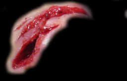 Scar 桌布 壁紙 — 黑色背景上，一個帶有撕裂肉體的原始血淋淋傷口的特寫。