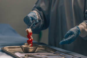 外科醫生在無菌手術環境中用鑷子處理帶血組織。 — 護士 壁紙