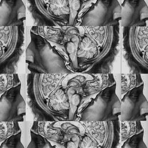解剖插圖，顯示男人的大腦透過重複網格中切開的頭骨暴露出來。 — 良醫墨非 壁紙