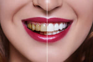 牙齒美白前後對比，顯示黃色牙齒轉變為白色。 — MacBook Air M2 壁紙